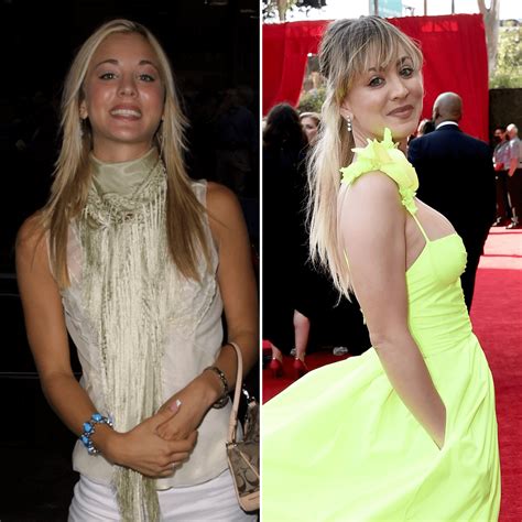 kaley cuoco breast implants|The Truth About Kaley Cuoco And Plastic Surgery.